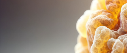 Cardiovascular Morbidity Patterns in Patients on Dialysis.